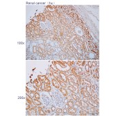 Solarbio K112199P Anti-COL4A4 Polyclonal Antibody