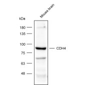 Solarbio K002046P Anti-CDH4 Polyclonal Antibody