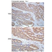 Solarbio K112421P Anti-HGF Polyclonal Antibody