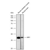 Solarbio K112225P Anti-MR1 Polyclonal Antibody