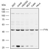 Solarbio K109962P Anti-FYN Polyclonal Antibody