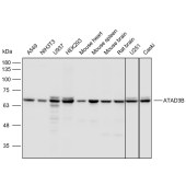Solarbio K112427P Anti-ATAD3B Polyclonal Antibody