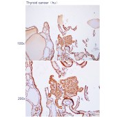 Solarbio K112280P Anti-HYAL3 Polyclonal Antibody