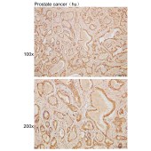 Solarbio K110098P Anti-DUSP10 Polyclonal Antibody