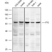 Solarbio K110456P Anti-FTO Polyclonal Antibody