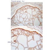 Solarbio K112277P Anti-GPR180 Polyclonal Antibody