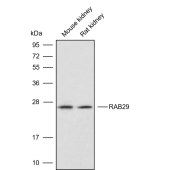 Solarbio K009839P Anti-RAB29 Polyclonal Antibody