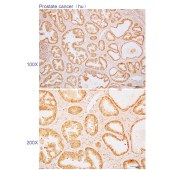 Solarbio K110366P Anti-STIP1 Polyclonal Antibody