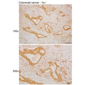 Solarbio K110027P Anti-ATAD4 Polyclonal Antibody