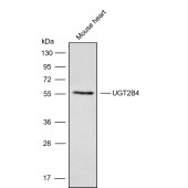 Solarbio K009809P Anti-UGT2B4 Polyclonal Antibody