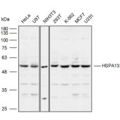 Solarbio K110104P Anti-HSPA13 Polyclonal Antibody
