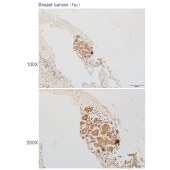 Solarbio K110521P Anti-TASOR2 Polyclonal Antibody