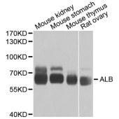 Solarbio K002764P Anti-ALB Polyclonal Antibody