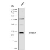 Solarbio K112238P Anti-ORMDL3 Polyclonal Antibody