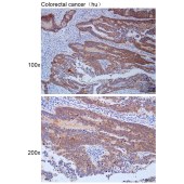 Solarbio K112203P Anti-NFAT5 Polyclonal Antibody