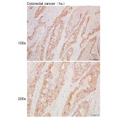 Solarbio K110276P Anti-BDKRB1 Polyclonal Antibody