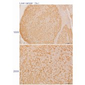 Solarbio K110279P Anti-CYP4A11 Polyclonal Antibody
