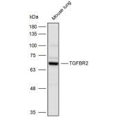 Solarbio K110508P Anti-TGFBR2 Polyclonal Antibody