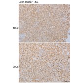 Solarbio K110341P Anti-USPL1 Polyclonal Antibody
