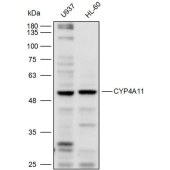 Solarbio K110278P Anti-CYP4A11 Polyclonal Antibody