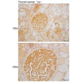 Solarbio K110034P Anti-CHRNA6 Polyclonal Antibody