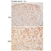 Solarbio K110487P Anti-NTAQ1 Polyclonal Antibody