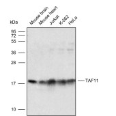 Solarbio K009807P Anti-TAF11 Polyclonal Antibody