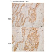 Solarbio K110059P Anti-NBPF1 Polyclonal Antibody