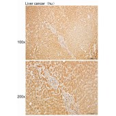 Solarbio K110133P Anti-NXNL1 Polyclonal Antibody