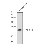 Solarbio K009814P Anti-ABHD14B Polyclonal Antibody