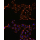 Solarbio K009770P Anti-HSPA4L Polyclonal Antibody