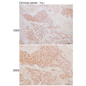 Solarbio K110067P Anti-MCM5 Polyclonal Antibody