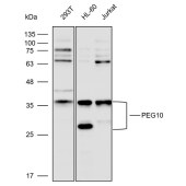 Solarbio K112309P Anti-PSME3IP1 Polyclonal Antibody