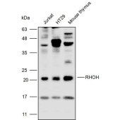 Solarbio K109928P Anti-RHOH Polyclonal Antibody