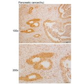 Solarbio K110032P Anti-SNX17 Polyclonal Antibody