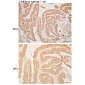 Solarbio K110466P Anti-CYLD Polyclonal Antibody