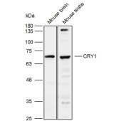 Solarbio K110080P Anti-CRY1 Polyclonal Antibody