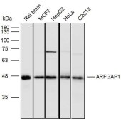 Solarbio K110312P Anti-ARFGAP1 Polyclonal Antibody