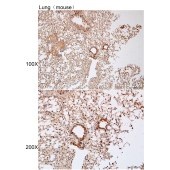 Solarbio K112214P Anti-ODF3 Polyclonal Antibody