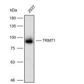 Solarbio K112226P Anti-TRMT1 Polyclonal Antibody