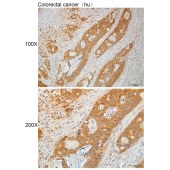 Solarbio K112258P Anti-MKRN2 Polyclonal Antibody