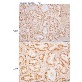 Solarbio K110482P Anti-ZNF503 Polyclonal Antibody