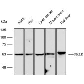 Solarbio K112424P Anti-PKLR Polyclonal Antibody