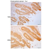 Solarbio K110041P Anti-GNPTG Polyclonal Antibody