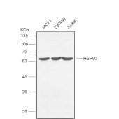 Solarbio K106543P Anti-HSPD1 Polyclonal Antibody