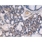 Solarbio K009814P Anti-ABHD14B Polyclonal Antibody