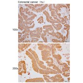Solarbio K110478P Anti-SRP54 Polyclonal Antibody