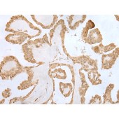 Solarbio K009819P Anti-ZNF281 Polyclonal Antibody