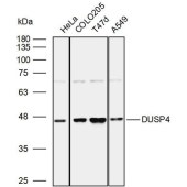 Solarbio K110002P Anti-DUSP4 Polyclonal Antibody