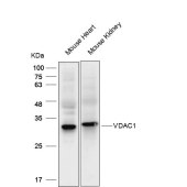 Solarbio K001750P Anti-VDAC1 Polyclonal Antibody